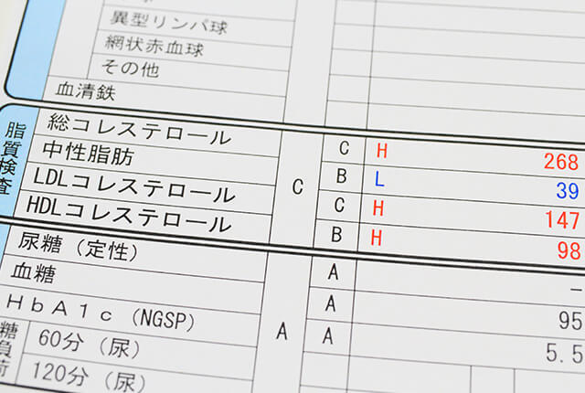 検診